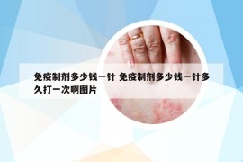 免疫制剂多少钱一针 免疫制剂多少钱一针多久打一次啊图片