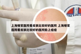 上海哪家医院看皮肤比较好的医院 上海哪家医院看皮肤比较好的医院脸上痘痘