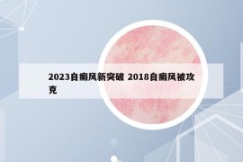 2023自癜风新突破 2018自癜风被攻克
