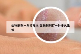 生物制剂一年打几次 生物制剂打一针多久生效