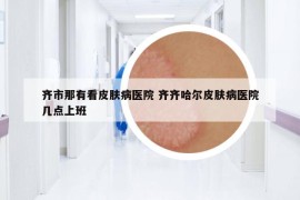 齐市那有看皮肤病医院 齐齐哈尔皮肤病医院几点上班