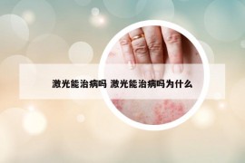 激光能治病吗 激光能治病吗为什么