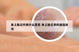 身上胎记代表什么意思 身上胎记多的迷信说法