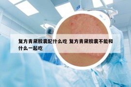 复方青黛胶囊配什么吃 复方青黛胶囊不能和什么一起吃