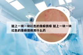 腿上一块一块红色的像癣很痒 腿上一块一块红色的像癣很痒用什么药