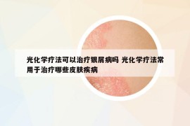 光化学疗法可以治疗银屑病吗 光化学疗法常用于治疗哪些皮肤疾病