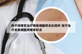南宁找哪家治疗银屑病医院会比较好 南宁治疗皮肤病医院哪家好点