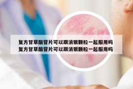 复方甘草酸苷片可以跟消银颗粒一起服用吗 复方甘草酸苷片可以跟消银颗粒一起服用吗