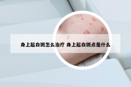 身上起白斑怎么治疗 身上起白斑点是什么