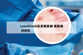 ruxolitinib乳膏银屑病 银屑病 润体乳