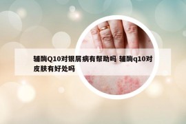 辅酶Q10对银屑病有帮助吗 辅酶q10对皮肤有好处吗