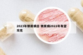 2023年银屑病日 银屑病2022年有望攻克