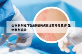 生物制剂皮下注射和静脉滴注那种效果好 生物制剂输注