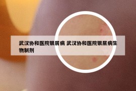 武汉协和医院银屑病 武汉协和医院银屑病生物制剂