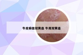牛皮癣兽双黄连 牛用双黄连