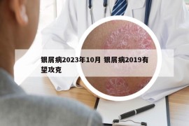 银屑病2023年10月 银屑病2019有望攻克
