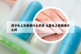 孩子头上长癣用什么药膏 儿童头上有癣用什么药