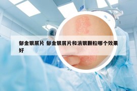 郁金银屑片 郁金银屑片和消银颗粒哪个效果好