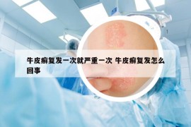 牛皮癣复发一次就严重一次 牛皮癣复发怎么回事