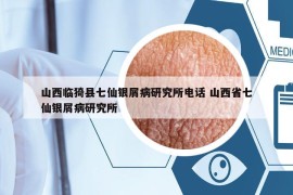 山西临猗县七仙银屑病研究所电话 山西省七仙银屑病研究所