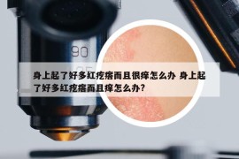 身上起了好多红疙瘩而且很痒怎么办 身上起了好多红疙瘩而且痒怎么办?