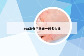 308准分子激光一般多少钱