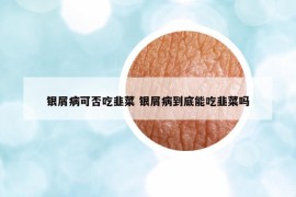 银屑病可否吃韭菜 银屑病到底能吃韭菜吗