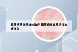 银屑病单克隆抗体治疗 银屑病单克隆抗体治疗多久