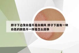 脖子下边发白是不是白癜风 脖子下面有一块白色的肤色不一样是怎么回事