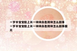 一岁半宝宝脸上长一块块白色斑块怎么回事 一岁半宝宝脸上长一块块白色斑块怎么回事图片