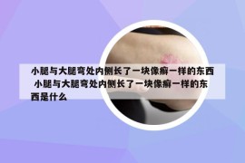 小腿与大腿弯处内侧长了一块像癣一样的东西 小腿与大腿弯处内侧长了一块像癣一样的东西是什么