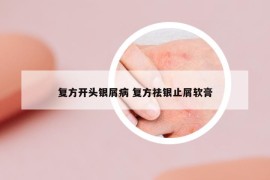 复方开头银屑病 复方祛银止屑软膏