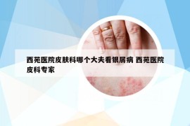 西苑医院皮肤科哪个大夫看银屑病 西苑医院皮科专家