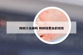 枸树汁治癣吗 枸树枝煮水的功效