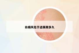 白癜风处于进展期多久