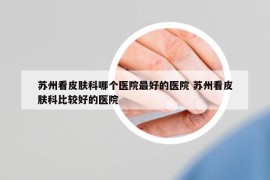 苏州看皮肤科哪个医院最好的医院 苏州看皮肤科比较好的医院