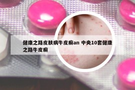 健康之路皮肤病牛皮癣an 中央10套健康之路牛皮癣