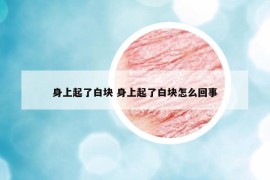 身上起了白块 身上起了白块怎么回事