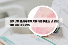 点滴状银屑病吃银屑灵颗粒还肤组合 点滴型银屑病吃消炎药吗