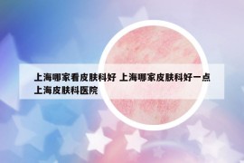 上海哪家看皮肤科好 上海哪家皮肤科好一点上海皮肤科医院