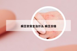 癣王软膏主治什么 癣王价格