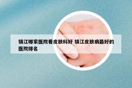 镇江哪家医院看皮肤科好 镇江皮肤病最好的医院排名