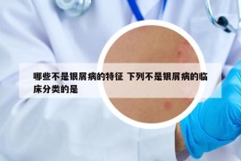 哪些不是银屑病的特征 下列不是银屑病的临床分类的是