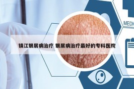 镇江银屑病治疗 银屑病治疗最好的专科医院