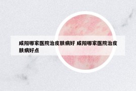 咸阳哪家医院治皮肤病好 咸阳哪家医院治皮肤病好点