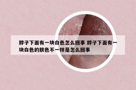 脖子下面有一块白色怎么回事 脖子下面有一块白色的肤色不一样是怎么回事