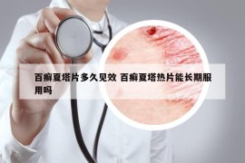 百癣夏塔片多久见效 百癣夏塔热片能长期服用吗