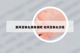 散风苦参丸银屑病吧 祛风苦参丸价格