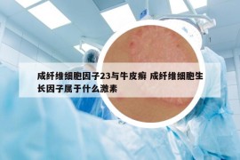 成纤维细胞因子23与牛皮癣 成纤维细胞生长因子属于什么激素