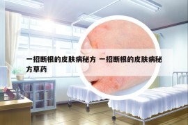 一招断根的皮肤病秘方 一招断根的皮肤病秘方草药